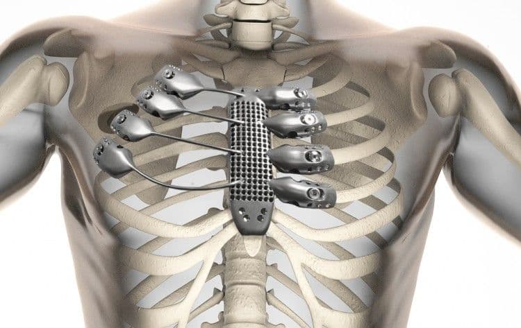 human radiography scan with bones
