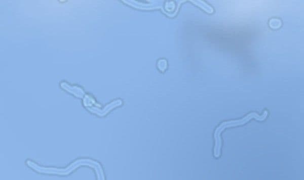 -Floaters-