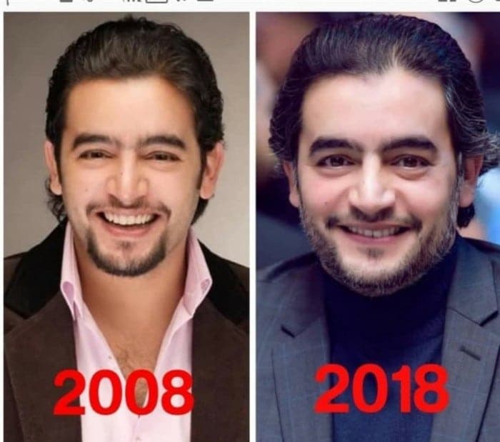 هاني سلامة تحدي العشر سنوات 
