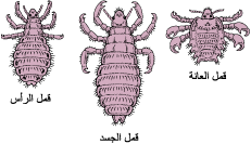louse-kinds