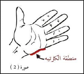 منطقة الكارتيه