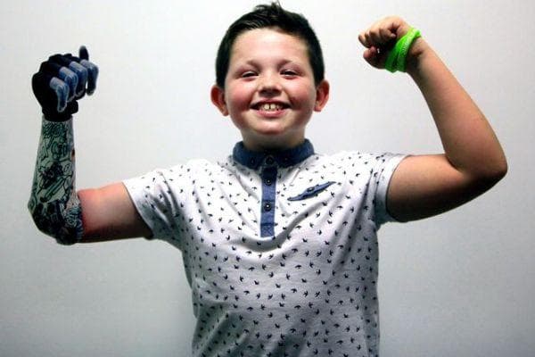 تطبيق هندسة البيونيك في ذراع البيونيك